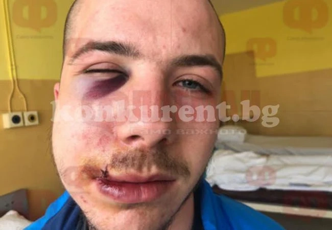 Татуирани мутри с боксове пребиха две момчета (СНИМКИ 18+)