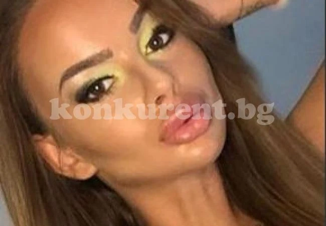Сузанита си клъцна носа срещу 6 бона
