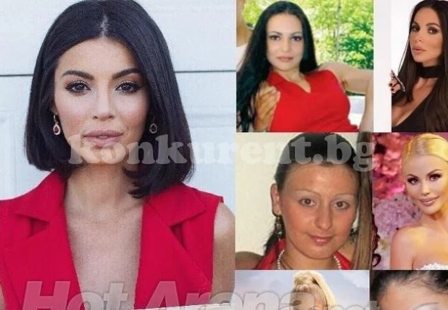 Комплексите на звездите: Мегз се срамува от говора си, Ева от гърдите, лекар обезобрази Мис Пиги и още…