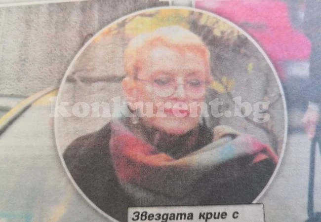 Пластичен хирург окепази Камелия Тодорова (Лицето на певицата увисна)