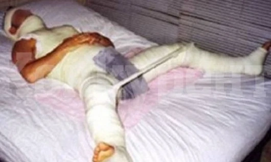 Мъж нахапа пениса на друг и го изпрати в болницата