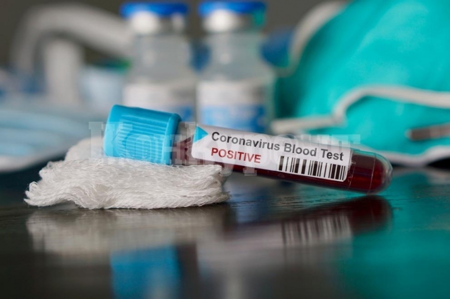 Отрицателни са вторите проби на двамата депутати със съмнение за коронавирус