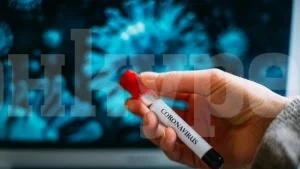 В частната МБАЛ „Сити клиник – Свети Георги“ в Монтана мерят температурата на всички влизащи в сградата