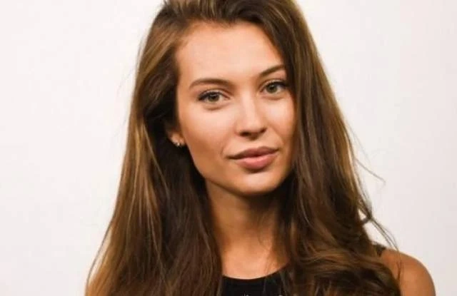 Разобличена! Никол Станкулова лъже, че устните й са естествени