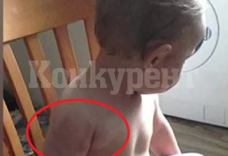 Ужас в Мурсалево! Подивял от ревност пастрок нахапа и преби бебе, защото приличало на баща си