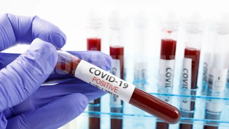 Чакат пробите на 8 жители от Врачанско за COVID-19