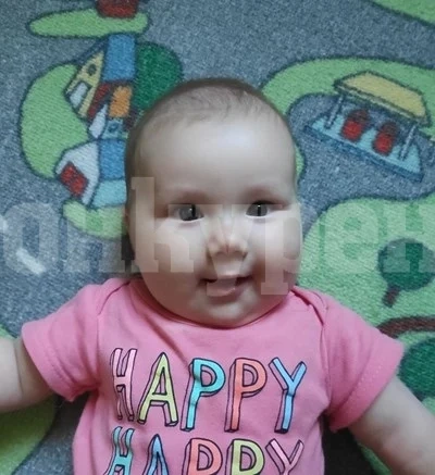 7-месечната Софи има нужда от помощ