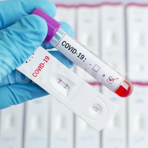 Глобиха жена, отказала тест за COVID – 19