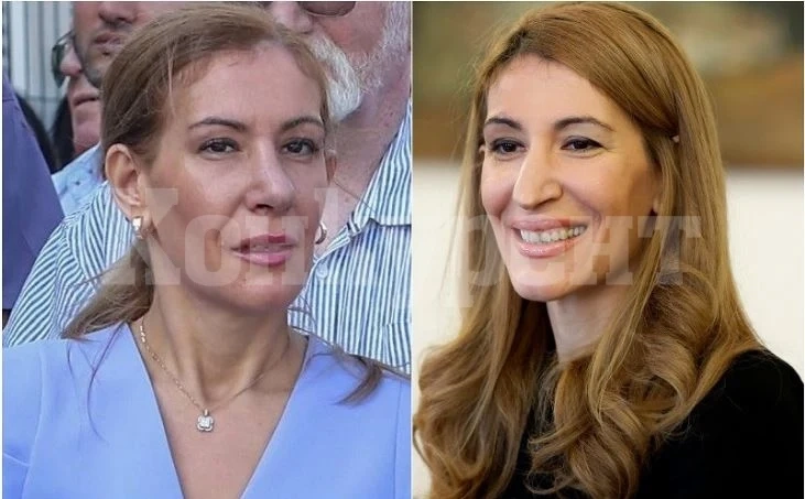 Николина Ангелкова си оперира носа за малко над 6 бона