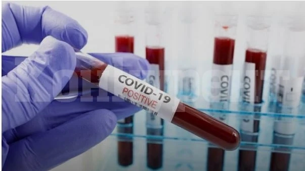 70% от преболедувалите COVID-19 са застрашени от инфаркт