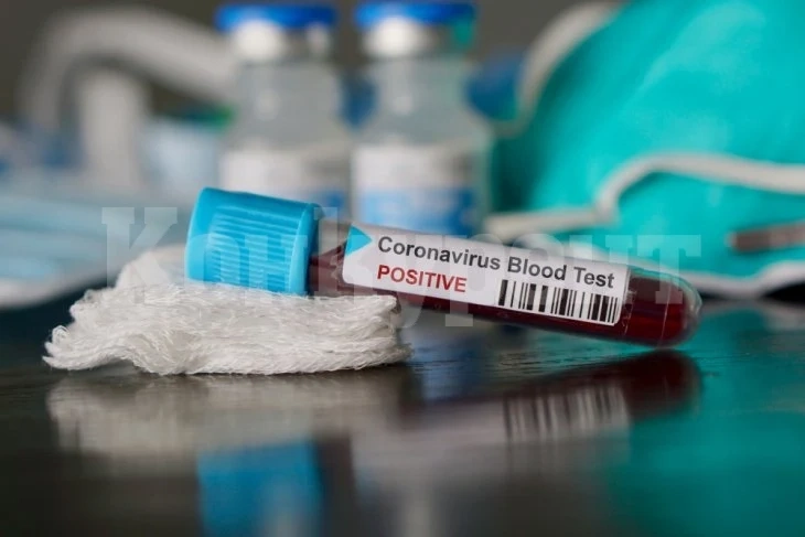 Скръбна вест: COVID-19 отне живота на лекарка в Хасково само за 3 дни
