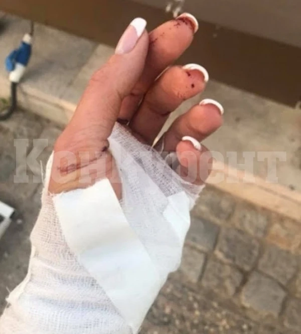 Бездомно куче нахапа полицайка във Вършец, опитала да му помогне