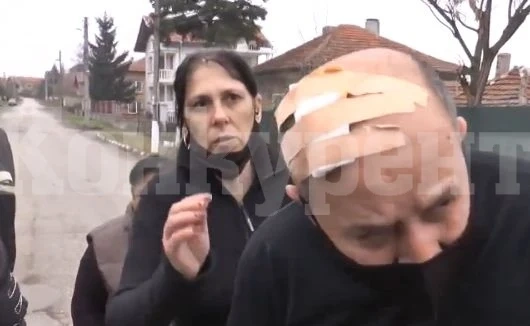Брутално нападение! Две ромски фамилии се сякоха с брадви във Видинско СНИМКИ
