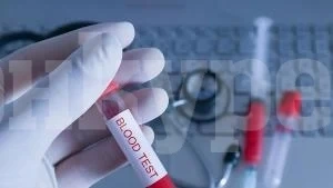 Още 117 в Северозапада имат коронавирус