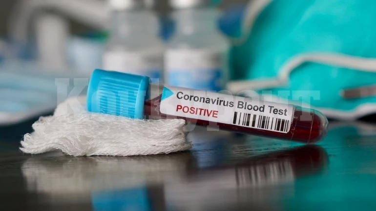 COVID пандемията няма спирка! Още 4-ма загубиха битката с вируса