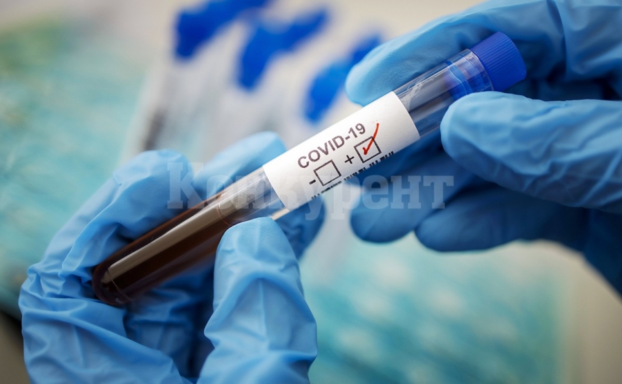 Регистрирани са 21 нови случаи на COVID-19 в област Видин