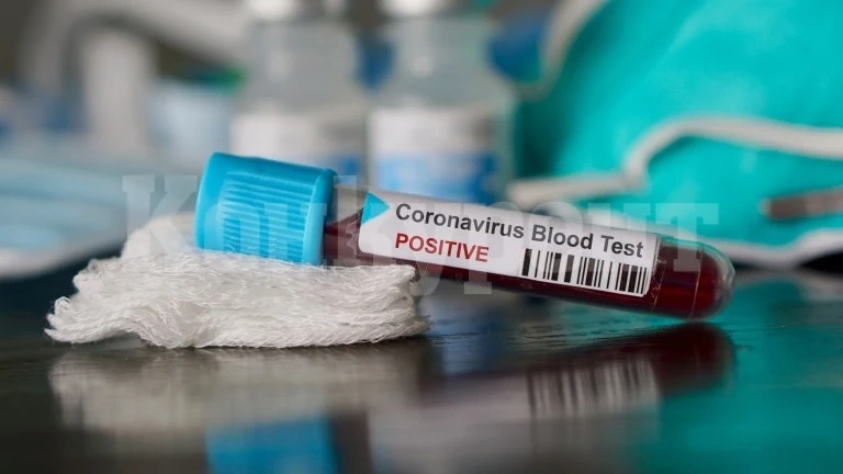 Още четири жени издъхнаха от COVID в Монтанско