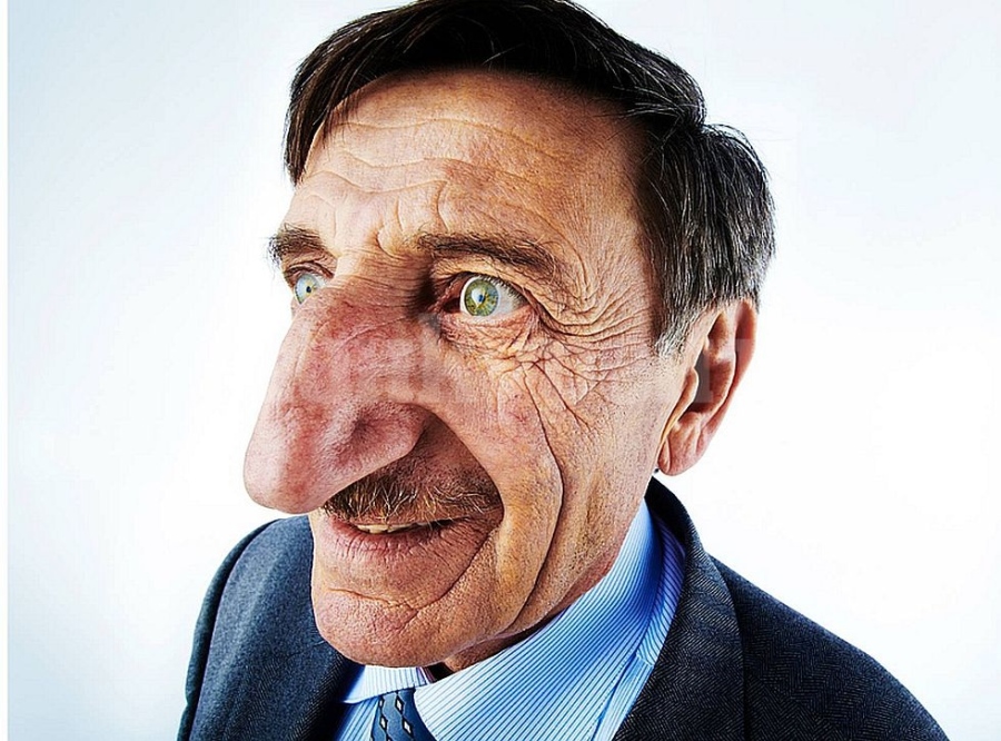 Мъж от Турция е с най-дългия нос в света ВИДЕО