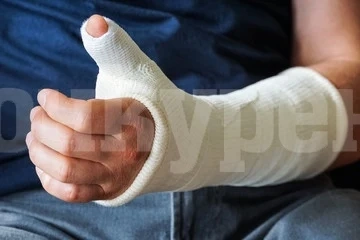 Бум на хора със счупени крайници във Враца