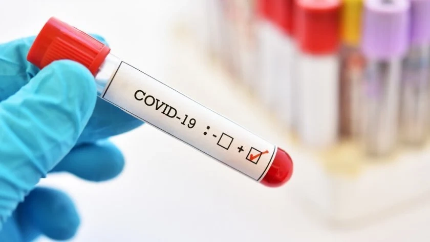 49 са новите случаи на Covid-19 в Северозапада