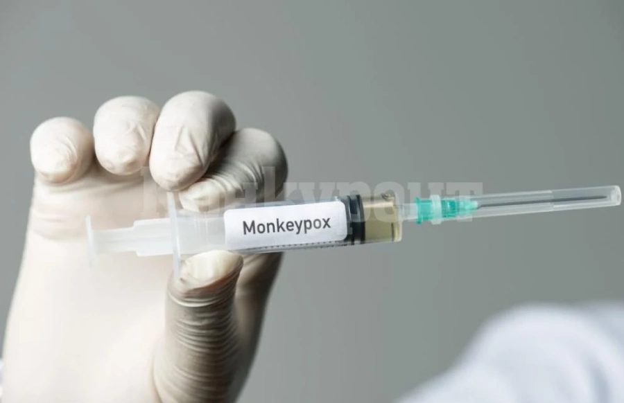 Случаят на маймунска шарка в Гърция не се потвърди, оказа се варицела