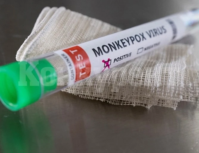 Втори случай на маймунска шарка в Гърция