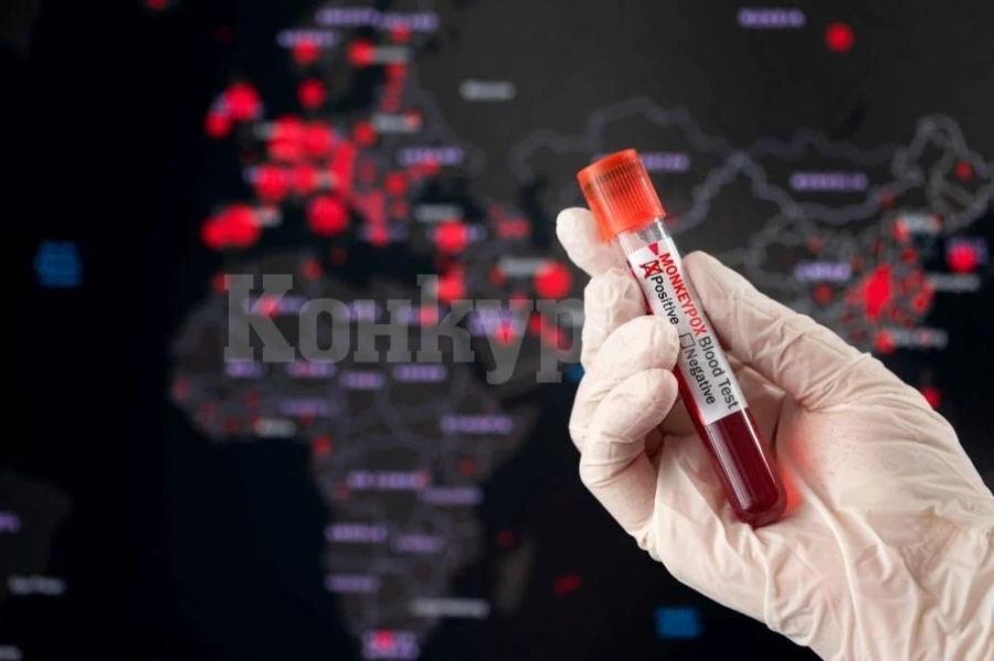 СЗО се събира спешно заради маймунската едра шарка