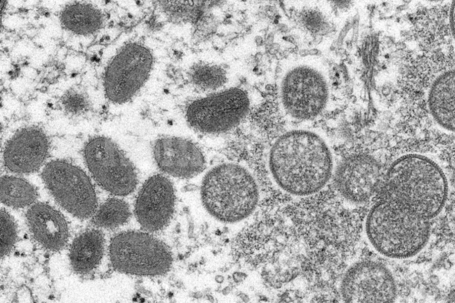 Започва международно изследване върху маймунската шарка