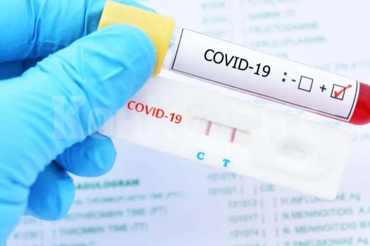 1862 са новозаразените с COVID-19 за последното денонощие, 79 са в Северозапада