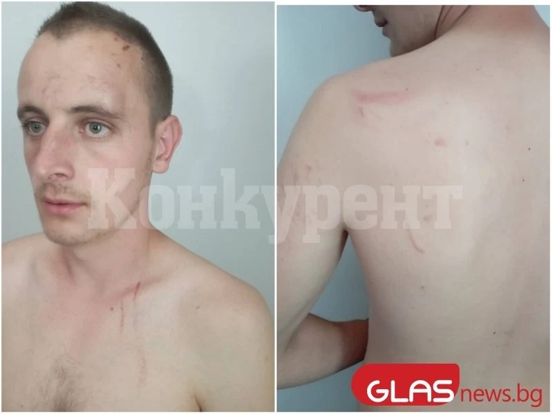 Бракониери пребиха жестоко 26-годишен горски край Кричим СНИМКИ