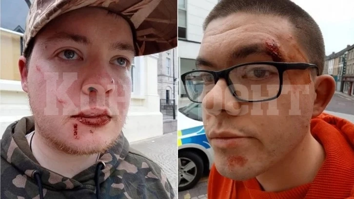Ритан и удрян до смърт: Кървава свада с над 20 гамени от България и Румъния в Северна Ирландия