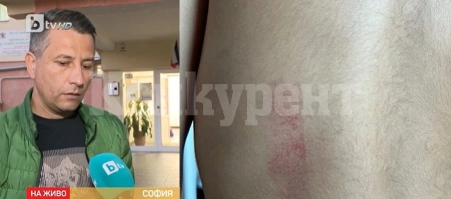 4-годишно момиченце се прибра посинено от детската градина