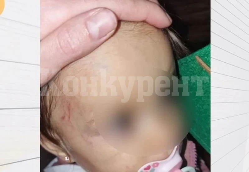 Дете на годинка пострада в частна занималня