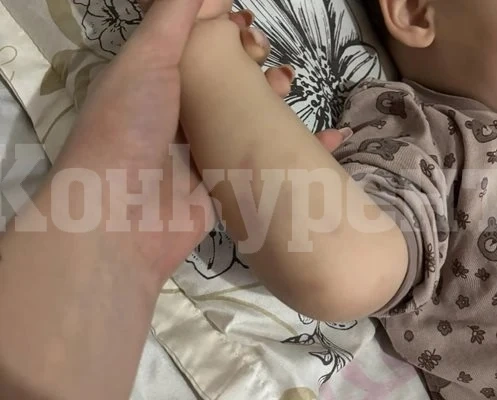 С множество синини и рани - родители от Плевен твърдят, че детето им е малтретирано в детска ясла (Снимки)