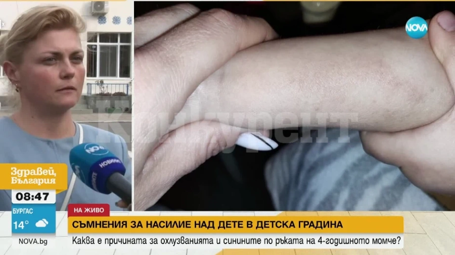 Майка твърди, че детето й е било обект на насилие в детска градина