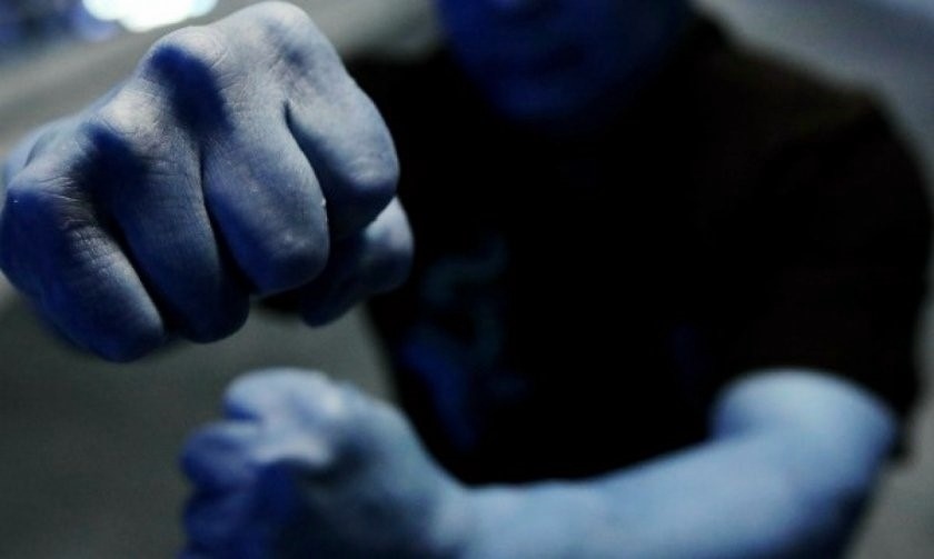 Мъж от Дунавци е в болница след побой