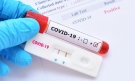 Увеличават се заразените с COVID в Монтанско 