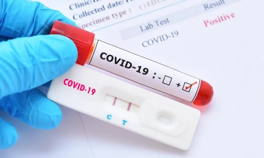 Увеличават се заразените с COVID в Монтанско